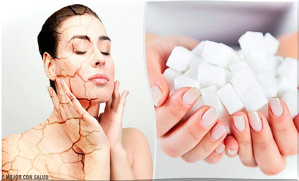 3 peels to fight dry skin