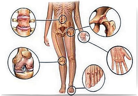 5 Natural Treatments for Joint Pain