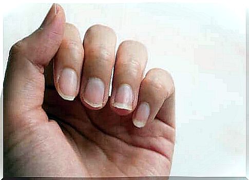 Four natural ingredients for brittle nails