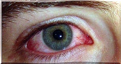 How do you prevent red eyes?  Causes and Remedies