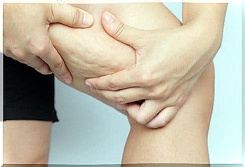 Cellulite on a woman's thigh