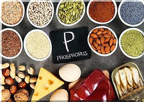 Hyperphosphatemia: Excessive phosphate in the blood