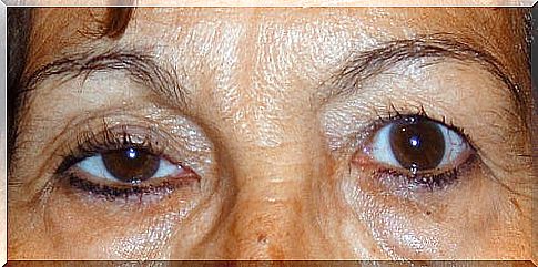 Improve droopy eyelids with these tips