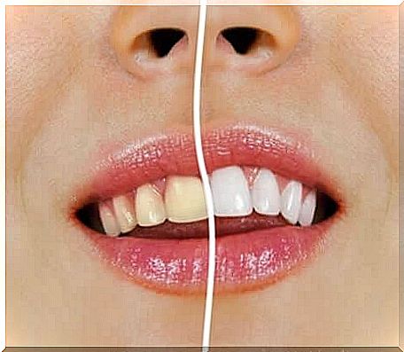 Natural teeth whitening products