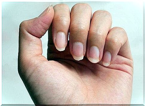 Nine remedies for brittle nails