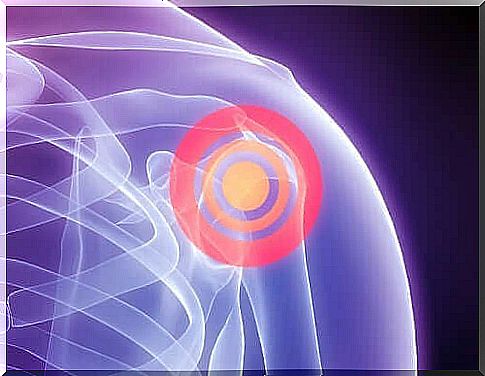 Stages of Treatment for Rotator Cuff Torn