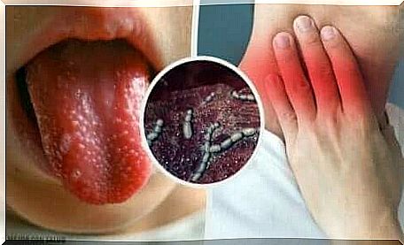 Scarlet fever in children: symptoms and treatments