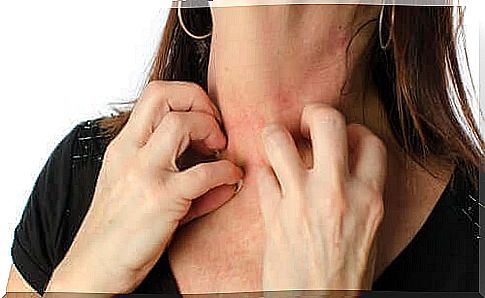 How to Prevent Skin Rashes