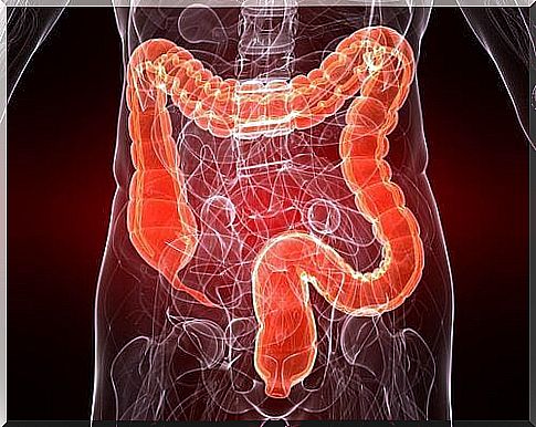 Ulcerative Colitis: Causes and Treatments