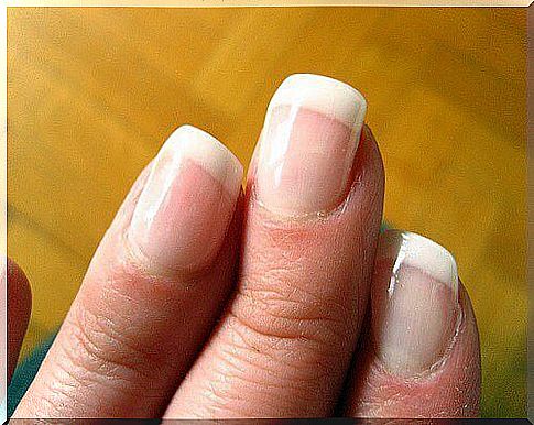 What do your nails say when they are discolored