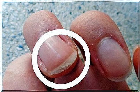 What do your nails say when they start flaking