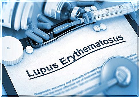 Types of lupus