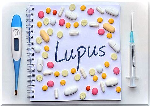 Recognizing Lupus